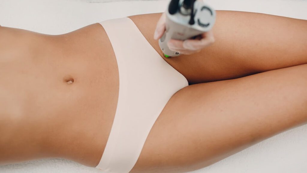 A professional using a laser device on the bikini line during a pubic hair removal session.