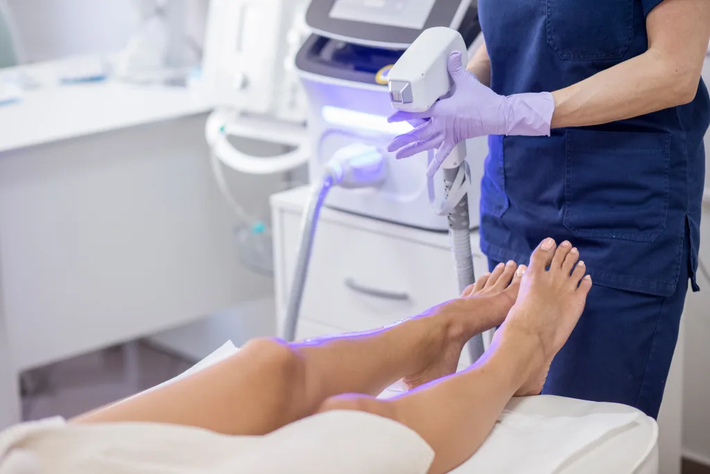 Diode laser hair removal