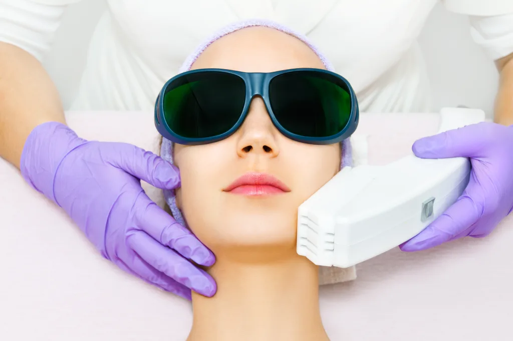 laser hair removal for face