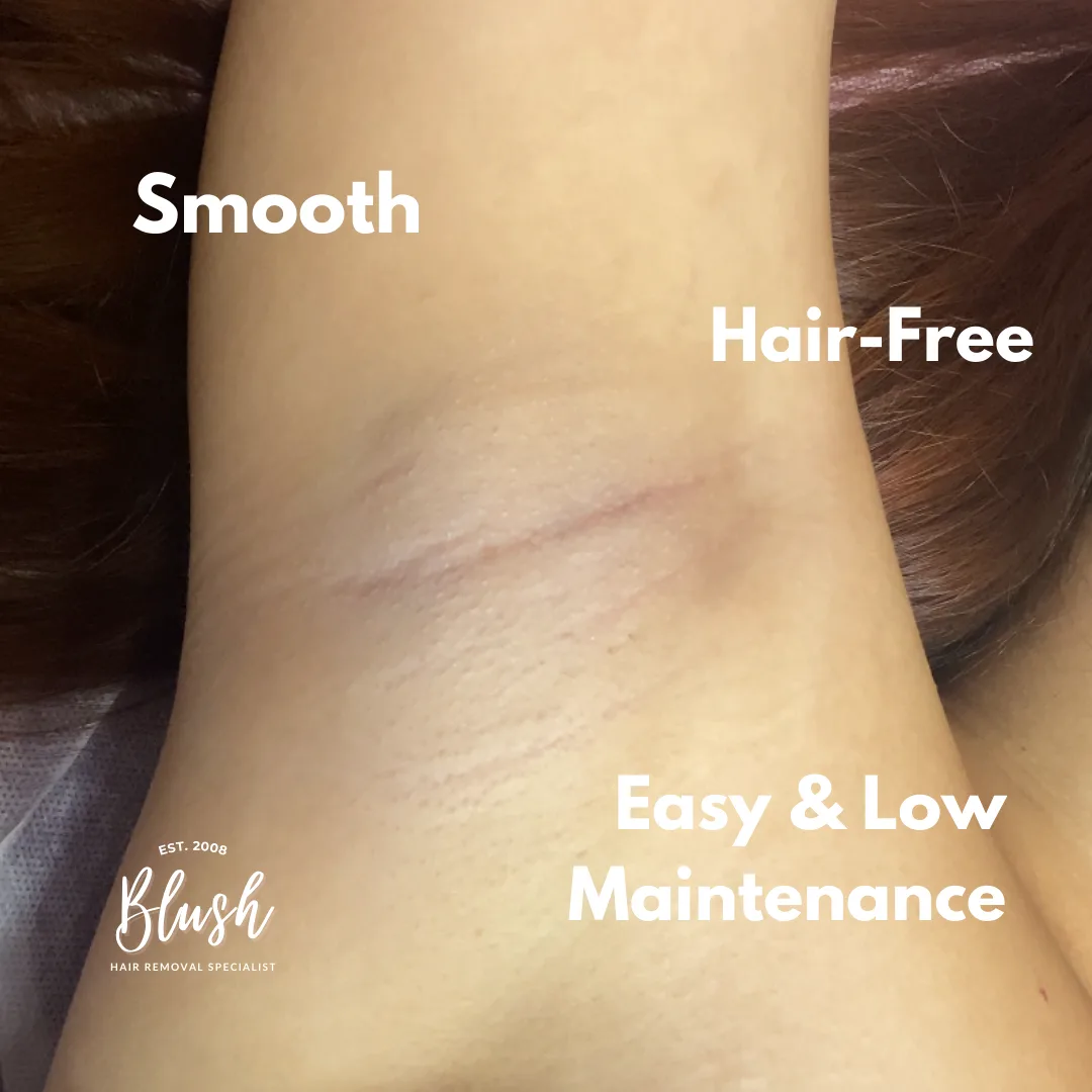 smooth, hair-free, easy & low maintenance