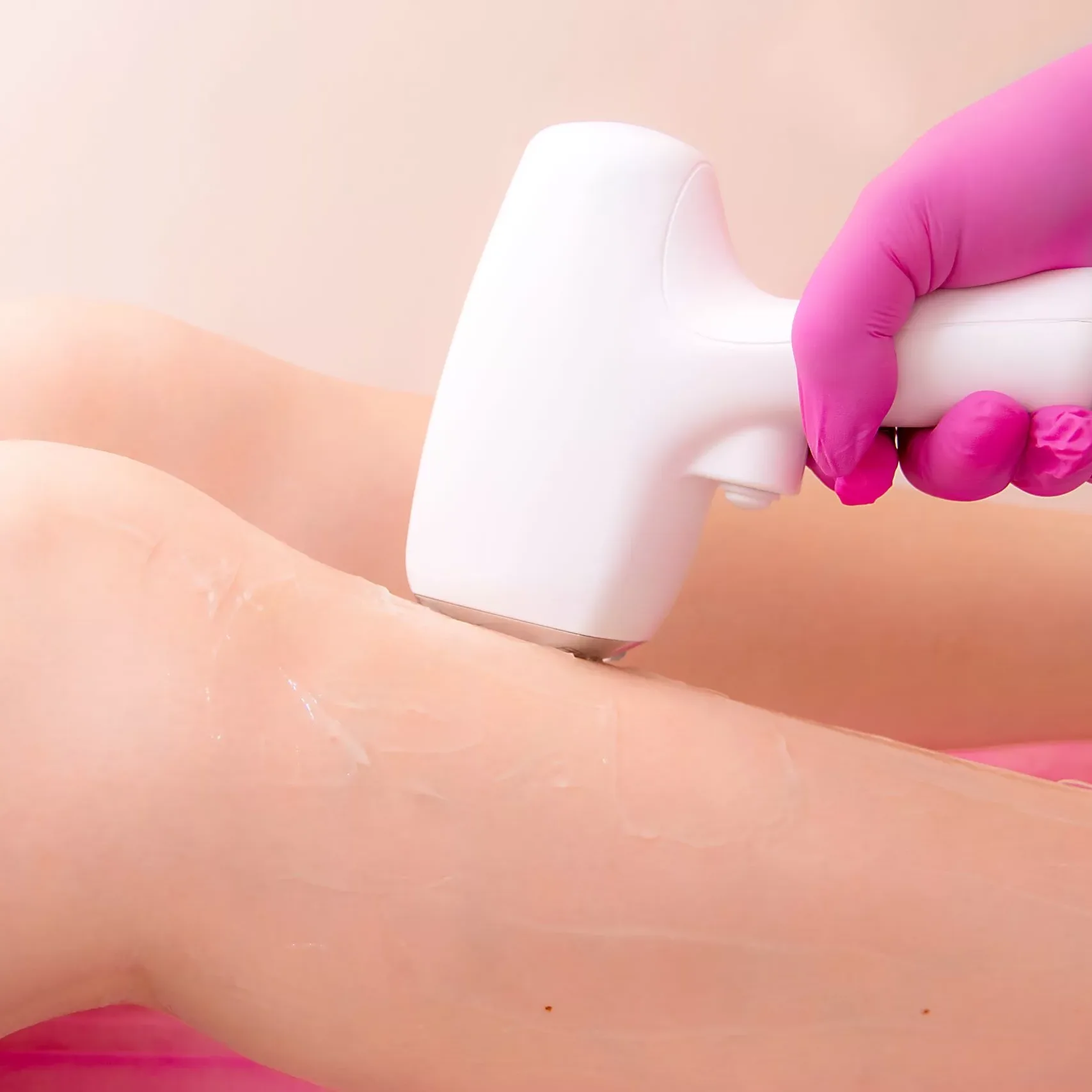 best permanent hair removal singapore